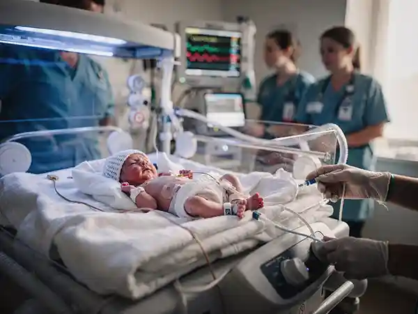 Newborn receiving therapeutic hypothermia (cooling treatment) for HIE in a NICU, with monitoring equipment and specialized cooling system