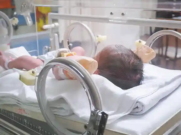 Obstetric team managing shoulder dystocia during delivery — the leading cause of brachial plexus birth injury