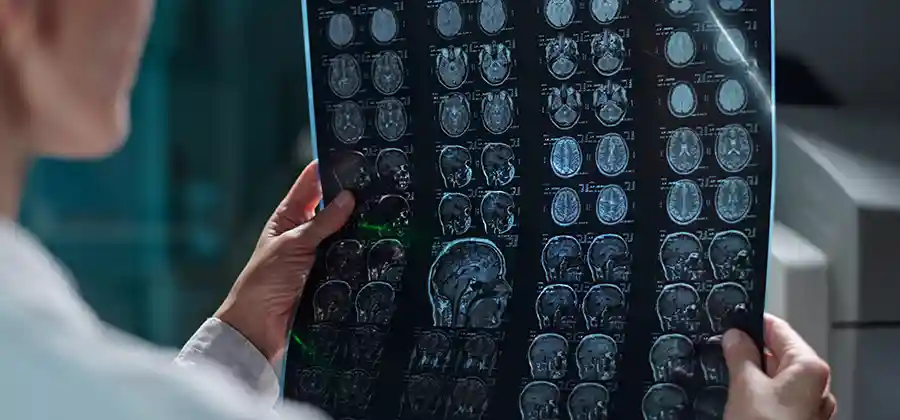MRI brain scan used in the cerebral palsy diagnosis process to identify brain injury or abnormalities in children