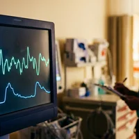 Would AI Fetal Heart Monitoring Lower Birth Trauma Rates?